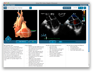 PIE: Virtual TEE, Transesophageal Echocardiography, 3D Heart Model, Cardiac  Echocardiogram