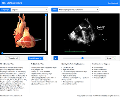 Virtual TEE: Standard Views, Cardiac, Transesophageal
