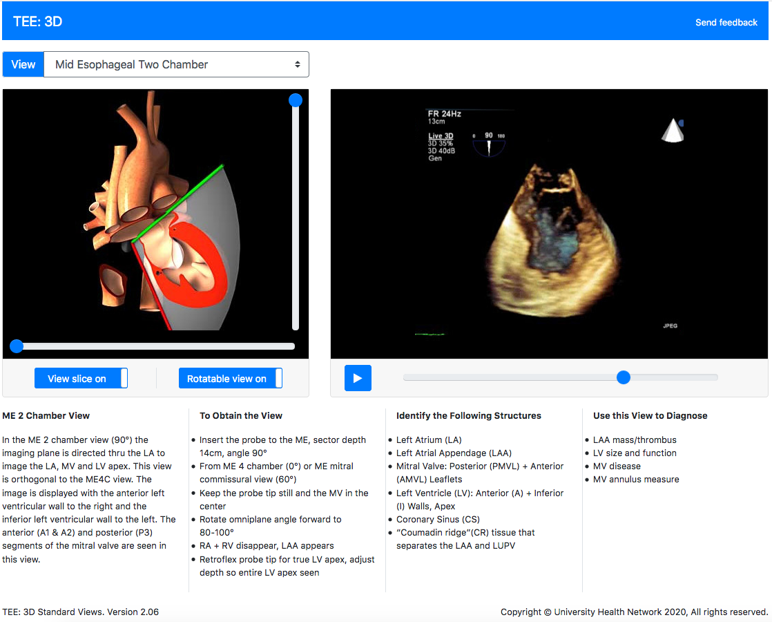 Virtual TEE: Standard Views, Cardiac, Transesophageal 