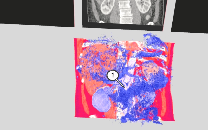 VR update: Operating room and Medical imaging VR modules VR update: Operating room and Medical imaging VR modules