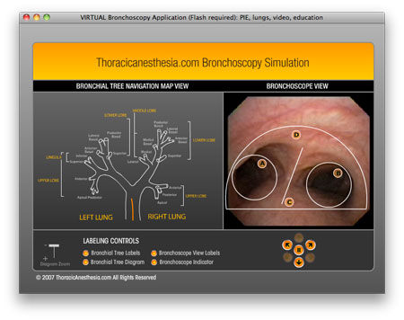 screen capture of the bronchoscopy simulation