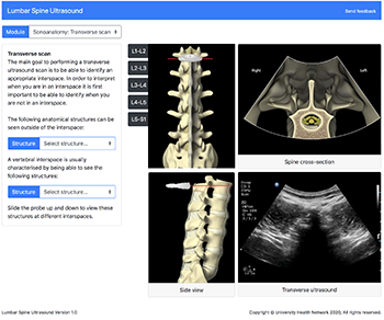 Virtual Spine: lumbar anatomy, 3D model, vertebra, flexion, range of  motion, sonoanatomy, ultrasound, regional anesthesia