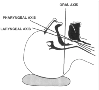 Airway - Extension of C-spine