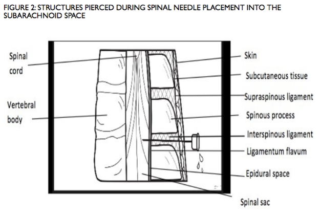 Spinal structures