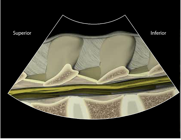 Spinal structures