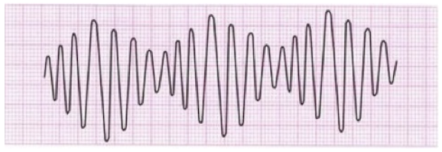 Cardiac arrest flow diagram