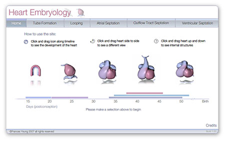 screen capture of the cardiac embryology application