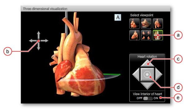 figure 1: Interactive heart model